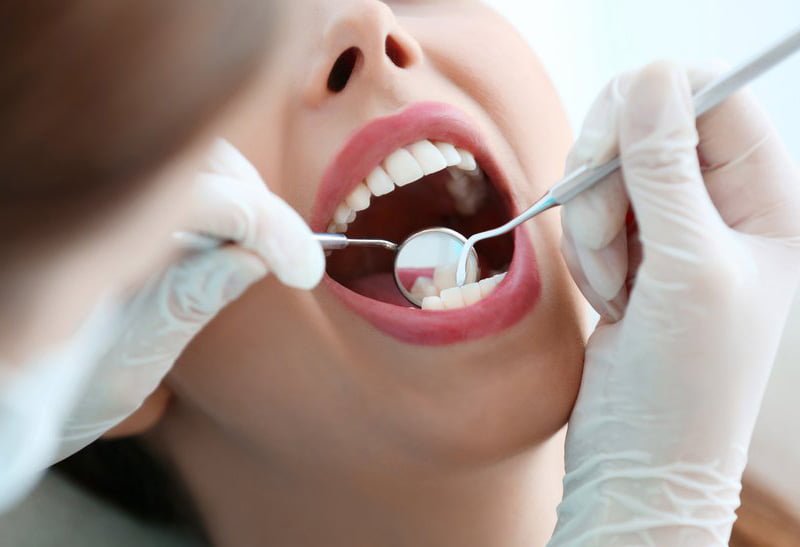 Ağız diş çene cerrahisi - Bodrum Diş Doktorları
