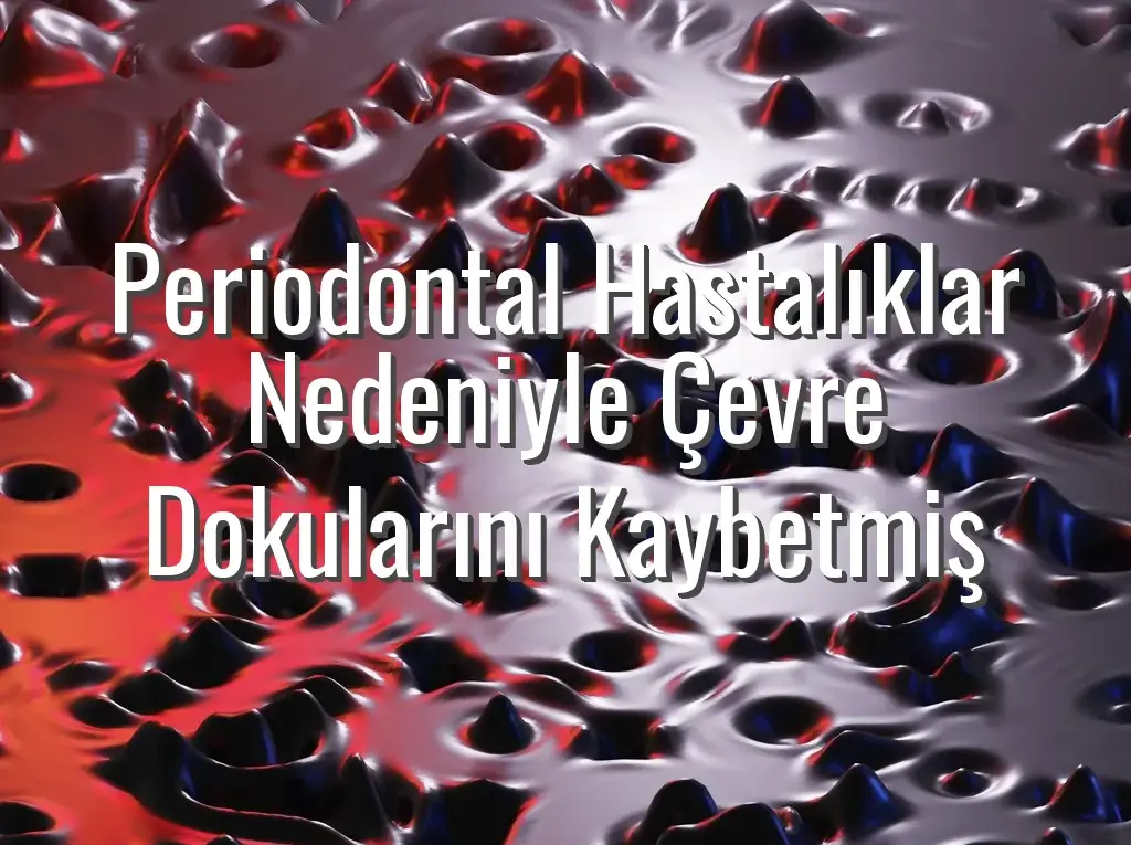 Periodontal Hastalıklar Nedeniyle Çevre Dokularını Kaybetmiş