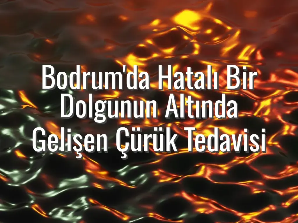 Bodrum'da Hatalı Bir Dolgunun Altında Gelişen Çürük Tedavisi